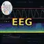 EEG spectrogram with a 16 by 16 skull projection, noise-density plot, and signal-chain equations