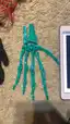Teal 3D printed finger and hand bone segments laid out on carpet Teal 3D printed finger and hand bone segments laid out on carpet